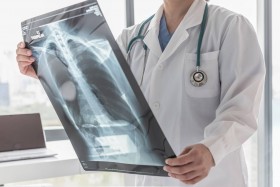 Doctor examining chest X-ray