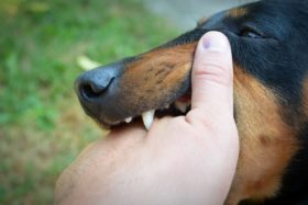 A dog bites a person's hand.